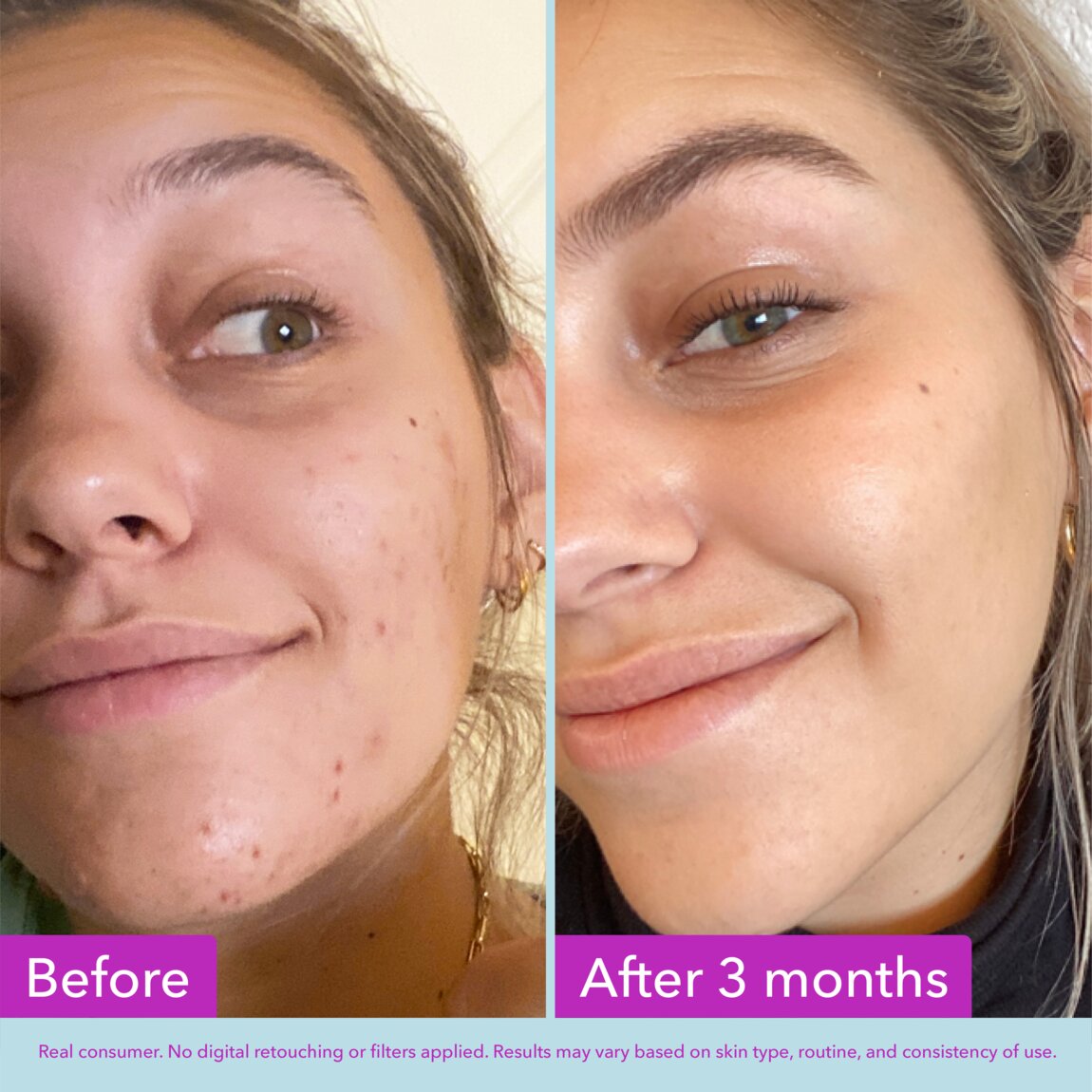 niacinamide-brightening-toner-m8 zb_p.jpg