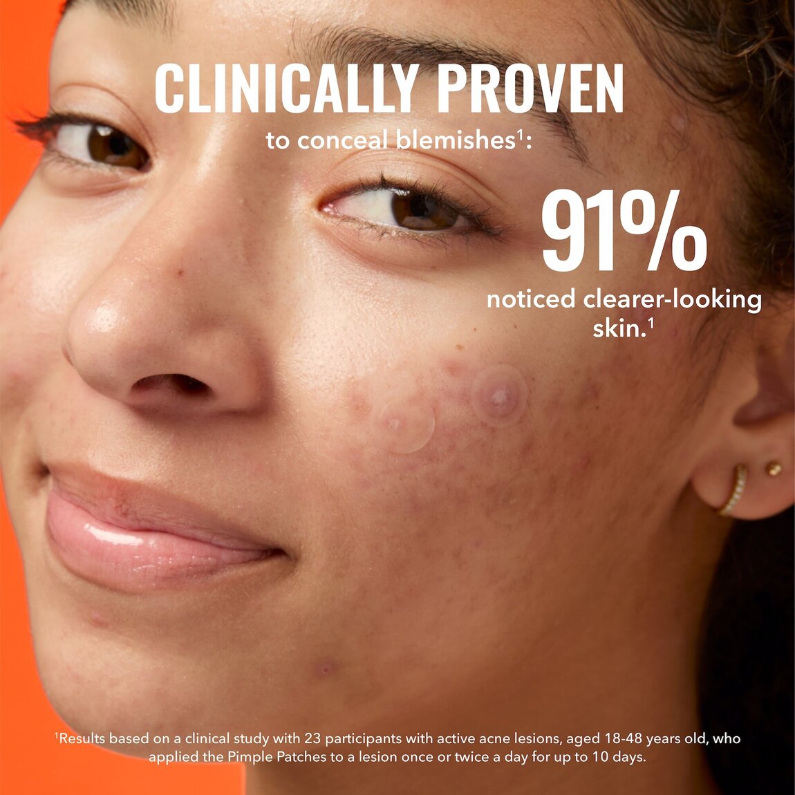 pimple-patches-s7 zb_p.jpg